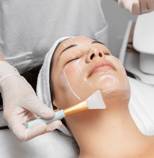 Chemical Peels